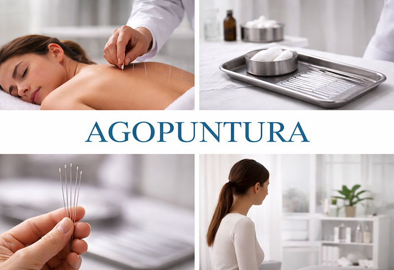 “Agopuntura